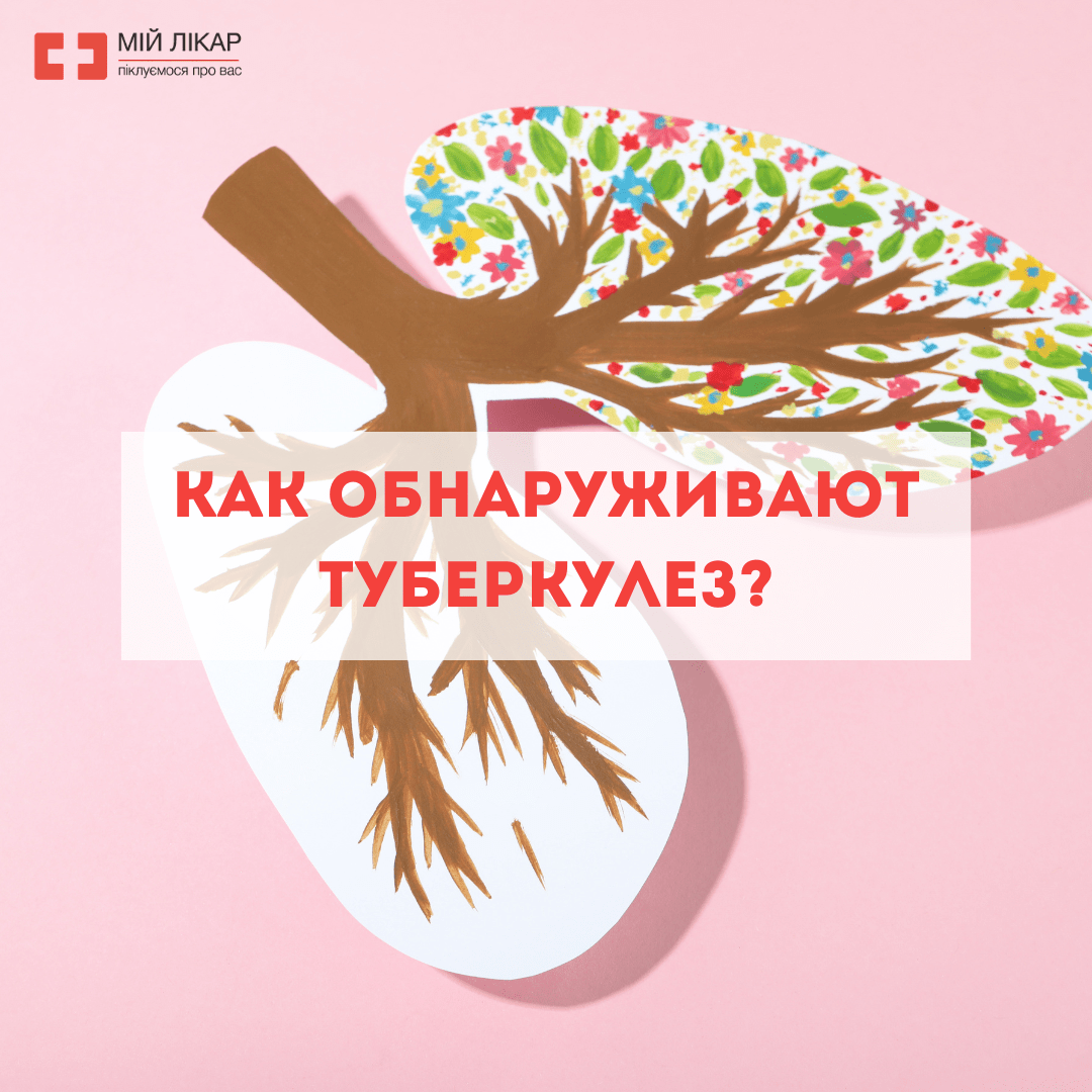 Как обнаруживают туберкулез? - Медицинский центр «Мій лікар»